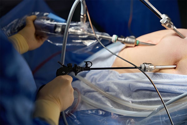 Cirugia Laparoscópica Cuenca Dr David Barzallo